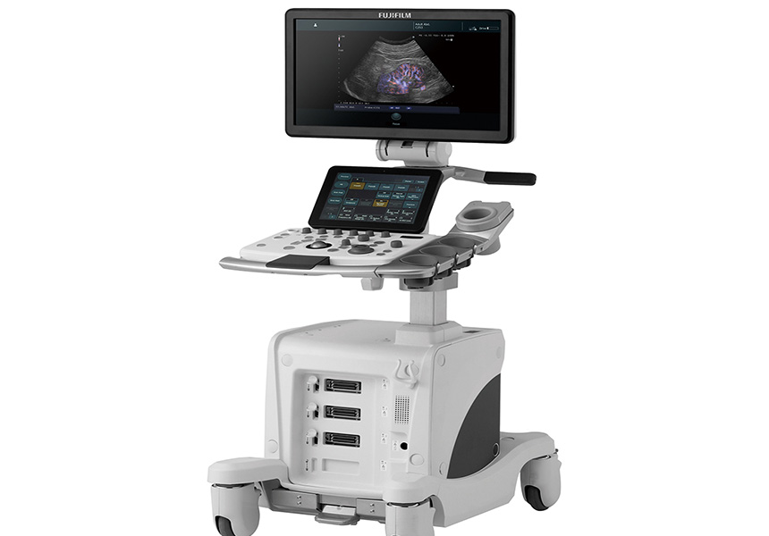 超音波診断装置（エコー機器）